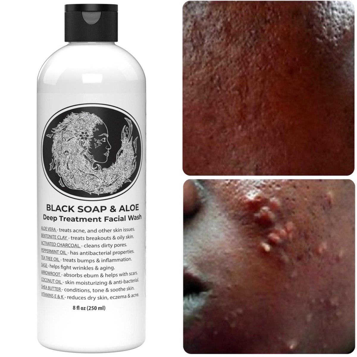 Natural Black Soap with Aloe