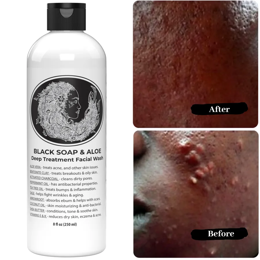 Before and after results