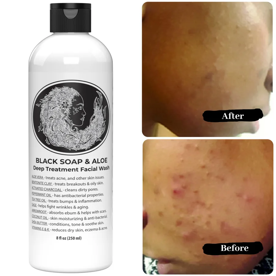 Customer skin-care example