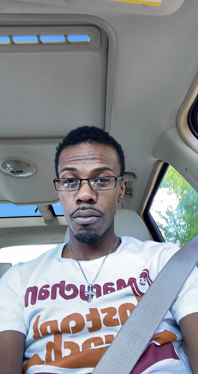 Hair growth result 3