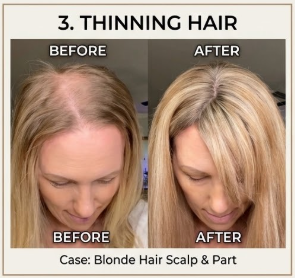 Before and after showing fuller-looking hair